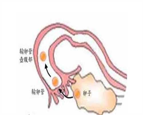 广州供卵助孕医院,广州超生二胎罚款标准